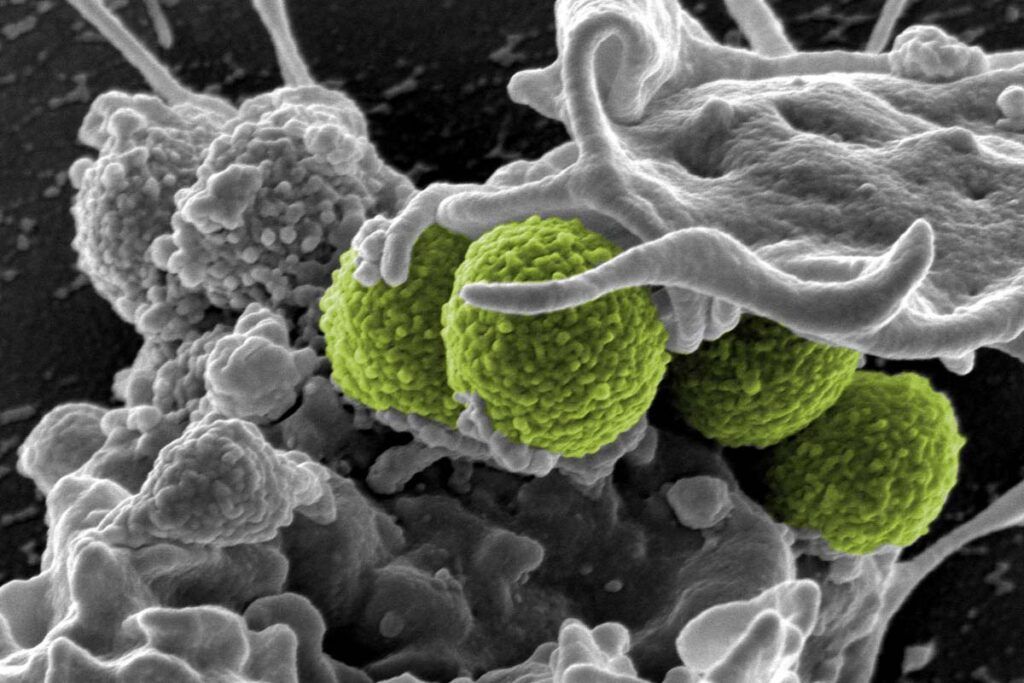 Resistencia antimicrobiana: innovadora vacuna frente a 'Staphylococcus aureus'