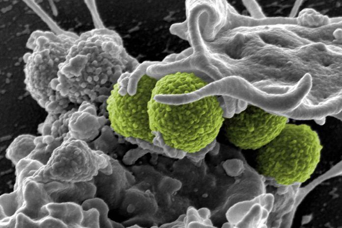 Staphylococcus aureus Resistencia antimicrobiana: innovadora vacuna frente a 'Staphylococcus aureus'