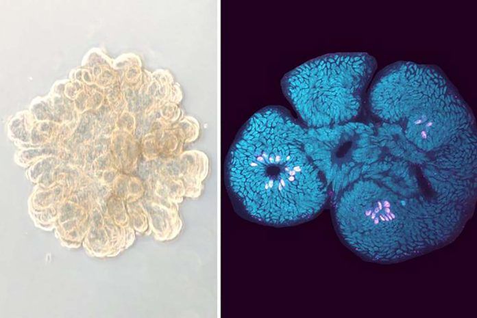 Hacia el primer fármaco para la enfermedad celíaca