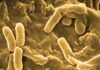 ¿Por qué las infecciones persisten en la fibrosis quística? ¿Por qué las infecciones persisten en la fibrosis quística?
