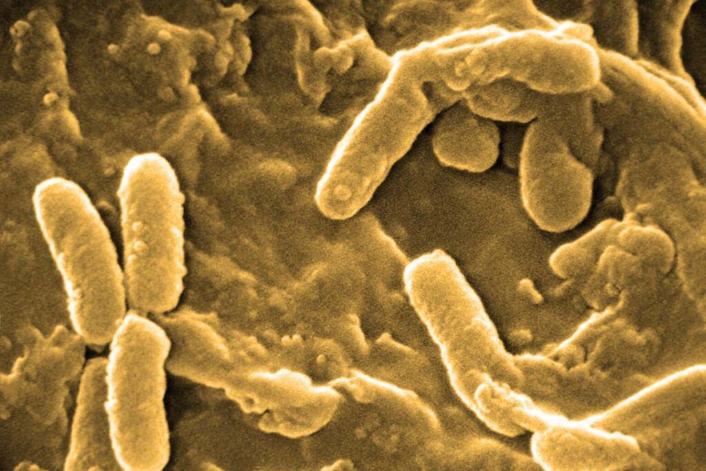 ¿Por qué las infecciones persisten en la fibrosis quística?