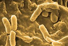 ¿Por qué las infecciones persisten en la fibrosis quística? ¿Por qué las infecciones persisten en la fibrosis quística?