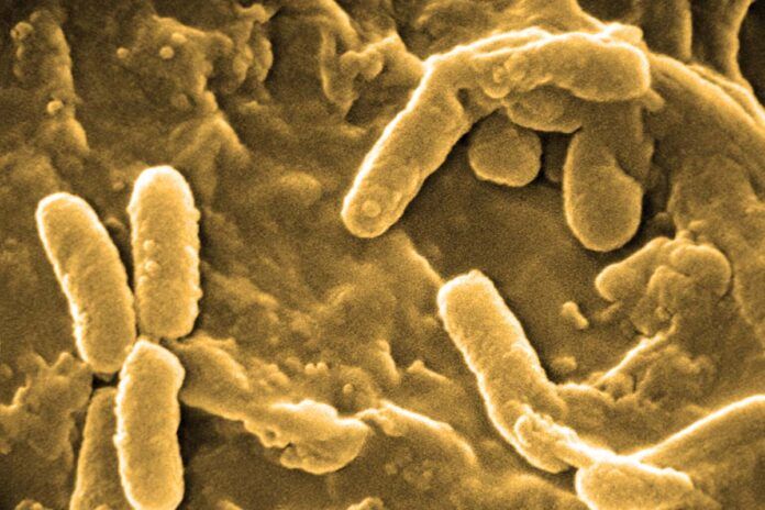 Pseudomonas aeruginosa ¿Por qué las infecciones persisten en la fibrosis quística?