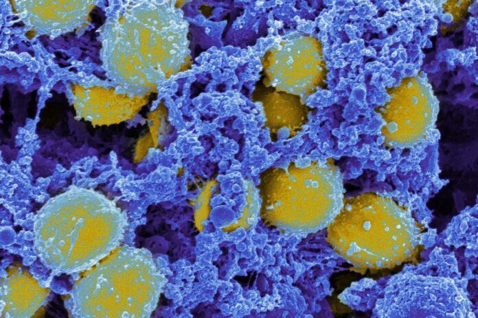 Staphylococcus aureus Estrategia con ‘tijeras biológicas’ contra infecciones bacterianas