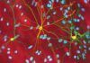Hacia un tratamiento para la enfermedad neurodegenerativa de Huntington Hacia un tratamiento para la enfermedad neurodegenerativa de Huntington