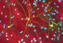 Hacia un tratamiento para la enfermedad neurodegenerativa de Huntington Hacia un tratamiento para la enfermedad neurodegenerativa de Huntington