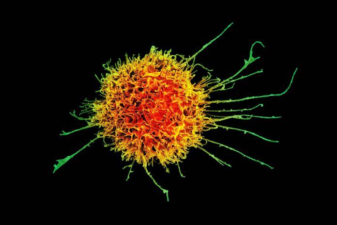 Desvelado el mecanismo molecular de la muerte celular inflamatoria