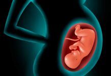 Hallan un vínculo entre el cordón umbilical y el TEA Hallan un vínculo entre el cordón umbilical y el TEA