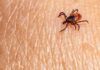 Alerta por el virus Powassan, que transmiten las garrapatas Alerta por el virus Powassan, que transmiten las garrapatas