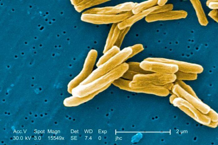 Tuberculosis: dos innovadoras candidatas a vacunas
