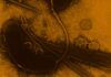 Desvelan la genética de la bacteria del cólera, clave para su prevención Desvelan la genética de la bacteria del cólera, clave para su prevención