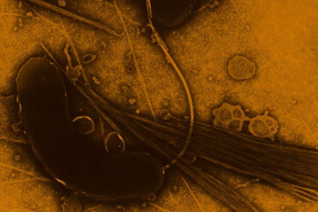 Desvelan la genética de la bacteria del cólera, clave para su prevención