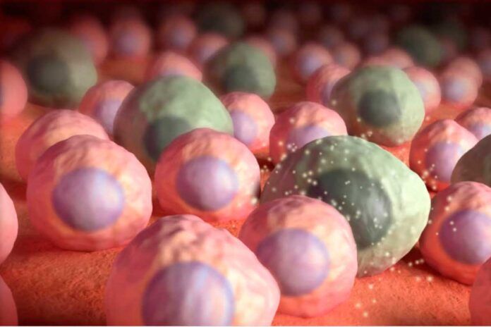 celulas-zombi Las células 'zombis' imitan a las cancerosas para evitar el sistema inmune
