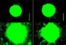 Ejercitar los músculos induce el crecimiento de las neuronas Ejercitar los músculos induce el crecimiento de las neuronas