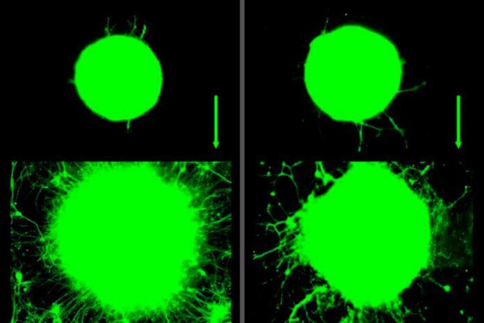 Ejercitar los músculos induce el crecimiento de las neuronas