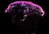 El primer mapa de la piel humana potenciará la medicina regenerativa El primer mapa de la piel humana potenciará la medicina regenerativa