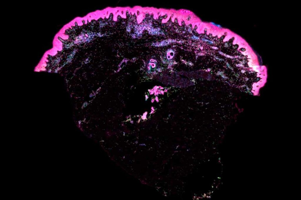 El primer mapa de la piel humana potenciará la medicina regenerativa