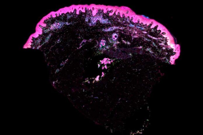 El primer mapa de la piel humana potenciará la medicina regenerativa