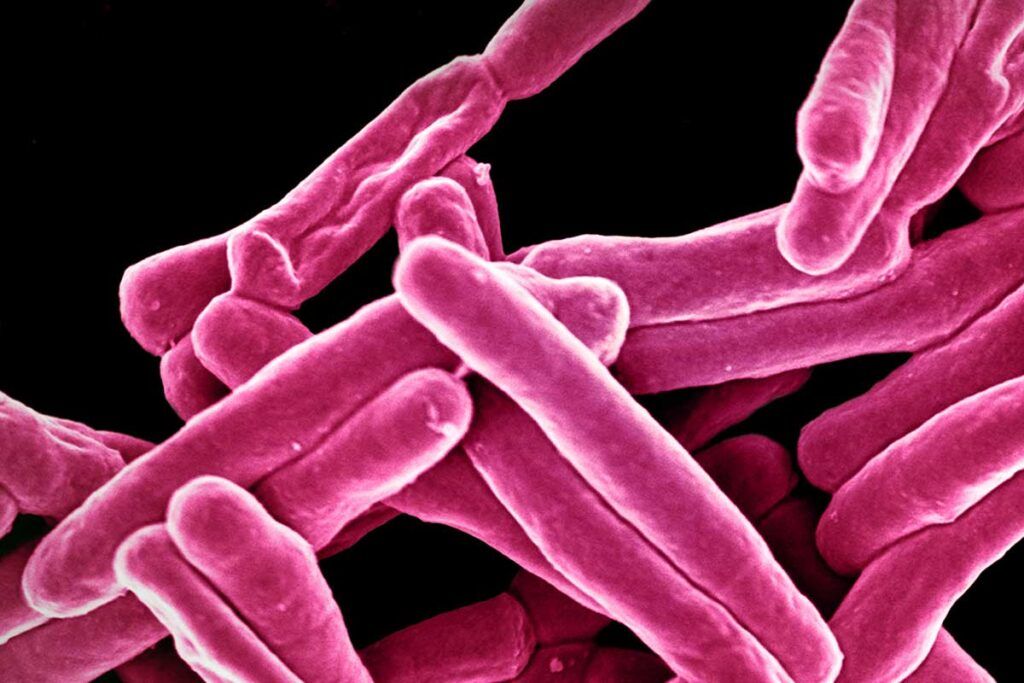Describen cómo las bacterias evaden a los antibióticos
