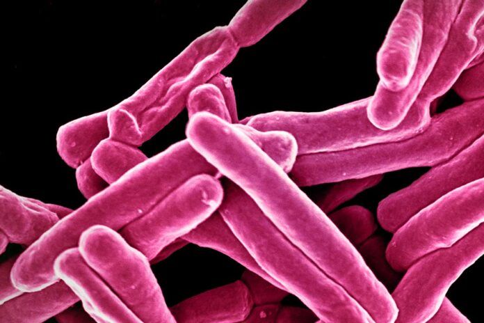 tuberculosis Describen cómo las bacterias evaden a los antibióticos