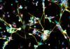 Un viejo antidepresivo, eficaz contra el glioblastoma Un viejo antidepresivo, eficaz contra el glioblastoma