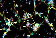 Un viejo antidepresivo, eficaz contra el glioblastoma Un viejo antidepresivo, eficaz contra el glioblastoma