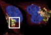 Ven por primera vez cómo las células cancerosas escapan del sistema inmune Ven por primera vez cómo las células cancerosas escapan del sistema inmune