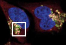 Ven por primera vez cómo las células cancerosas escapan del sistema inmune Ven por primera vez cómo las células cancerosas escapan del sistema inmune