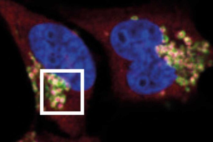 Ven por primera vez cómo las células cancerosas escapan del sistema inmune