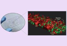Reproducen el colangiocarcinoma en un chip Reproducen el colangiocarcinoma en un chip