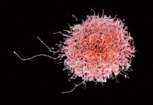‘Células asesinas’, eficaces contra la leucemia mieloide aguda ‘Células asesinas’, eficaces contra la leucemia mieloide aguda