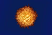 Sorpresa al vincular el herpes con el mal de Alzheimer Sorpresa al vincular el herpes con el mal de Alzheimer