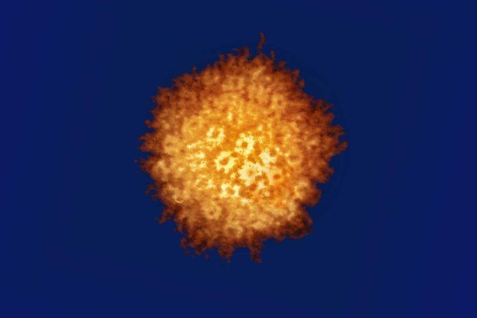 virus-herpes-simple Sorpresa al vincular el herpes con el mal de Alzheimer