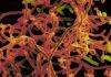 El virus del Ébola se transmite también por la piel El virus del Ébola se transmite también por la piel
