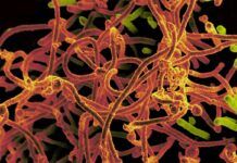 El virus del Ébola se transmite también por la piel El virus del Ébola se transmite también por la piel