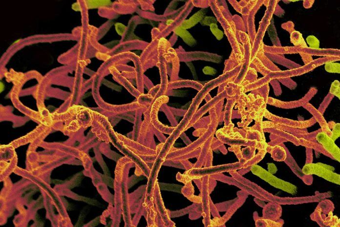 ebola El virus del Ébola se transmite también por la piel