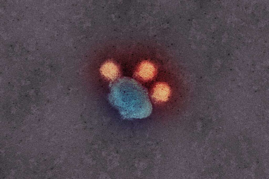 El virus del Zika provoca cambios metabólicos en la piel humana