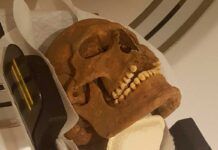 Los vikingos padecían graves enfermedades maxilofaciales Los vikingos padecían graves enfermedades maxilofaciales