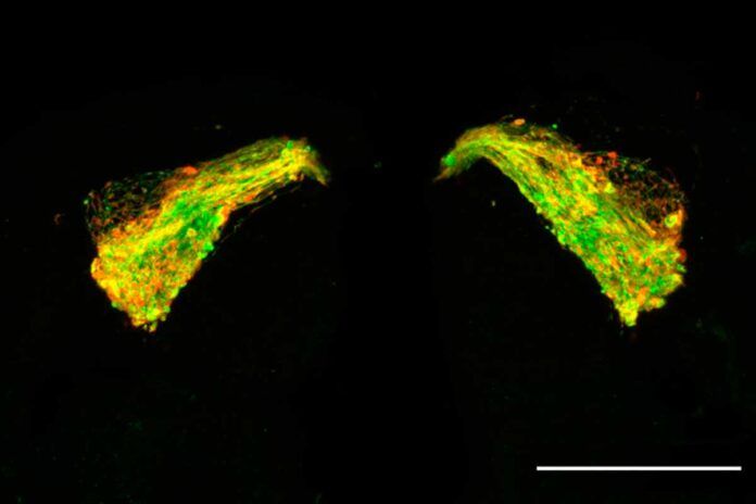 Innovadora molécula contra el Alzheimer