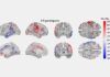Miden cómo envejece el cerebro con IA Miden cómo envejece el cerebro con IA