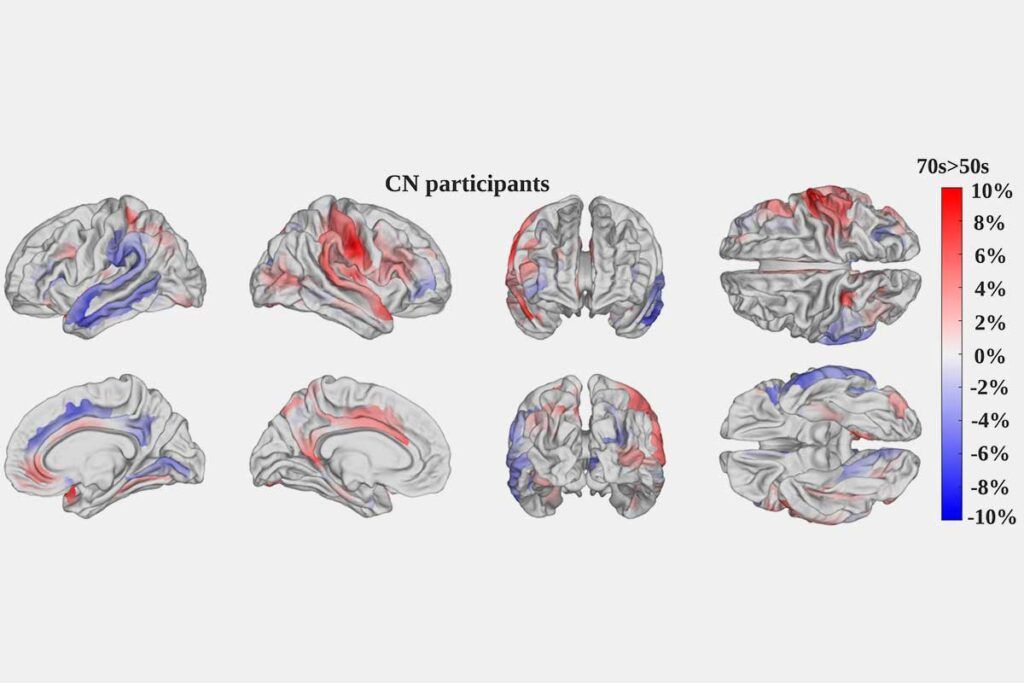 Miden cómo envejece el cerebro con IA