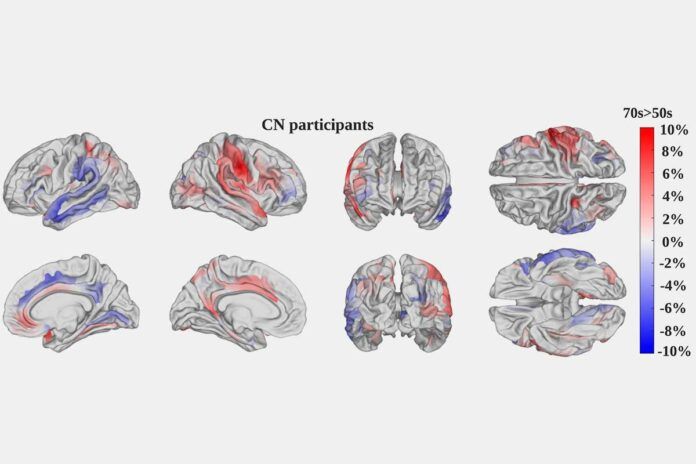 cerebro Miden cómo envejece el cerebro con IA