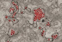 El virus Zika paraliza las células para evitar al sistema inmune El virus Zika paraliza las células para evitar al sistema inmune