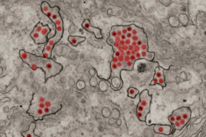 El virus Zika paraliza las células para evitar al sistema inmune