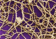 Avances en leptospirosis, el desconocido mal de áreas marginadas Avances en leptospirosis, el desconocido mal de áreas marginadas