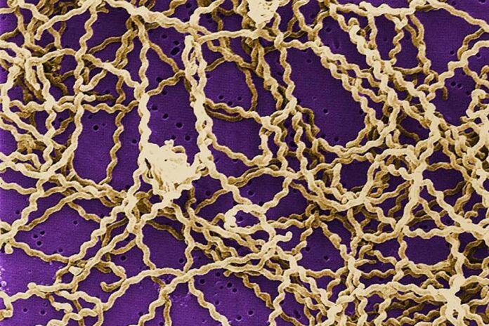 Avances en leptospirosis, el desconocido mal de áreas marginadas