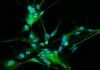 Visualizan cómo se multiplican las células cancerosas en el glioblastoma Visualizan cómo se multiplican las células cancerosas en el glioblastoma