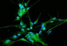 Visualizan cómo se multiplican las células cancerosas en el glioblastoma Visualizan cómo se multiplican las células cancerosas en el glioblastoma