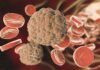 Nuevo diagnóstico rápido de sepsis Nuevo diagnóstico rápido de sepsis