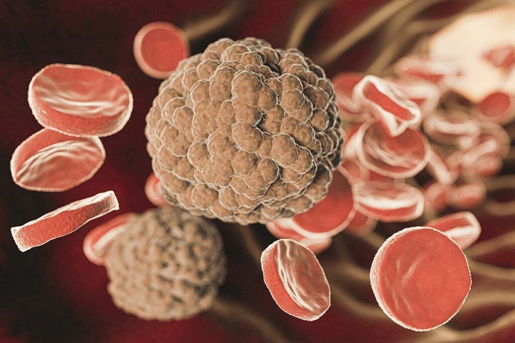 Nuevo diagnóstico rápido de sepsis
